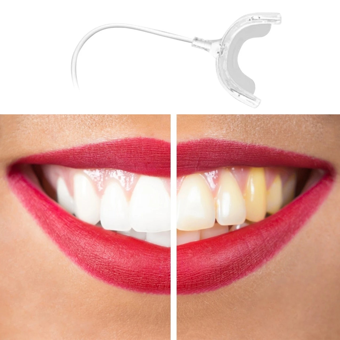 Smart LED Teeth Whitening Device - Portable USB Charging