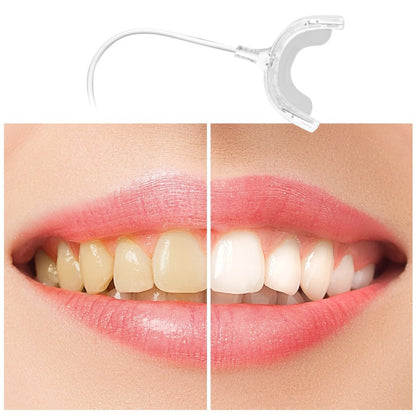Smart LED Teeth Whitening Device | Portable USB Charging
